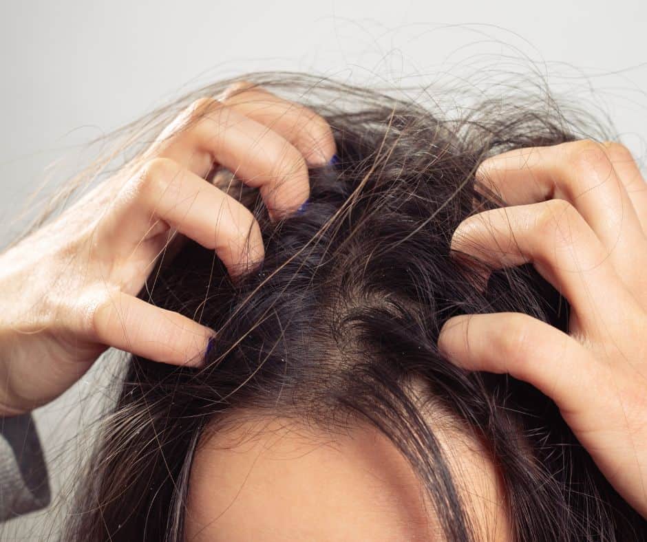 Head Lice making your Head Itch